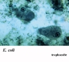 Deux formes trophozoïtes de l'amibe Entamoeba coli