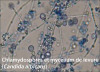 Chlamydospores et mycelium de Candida albicans.